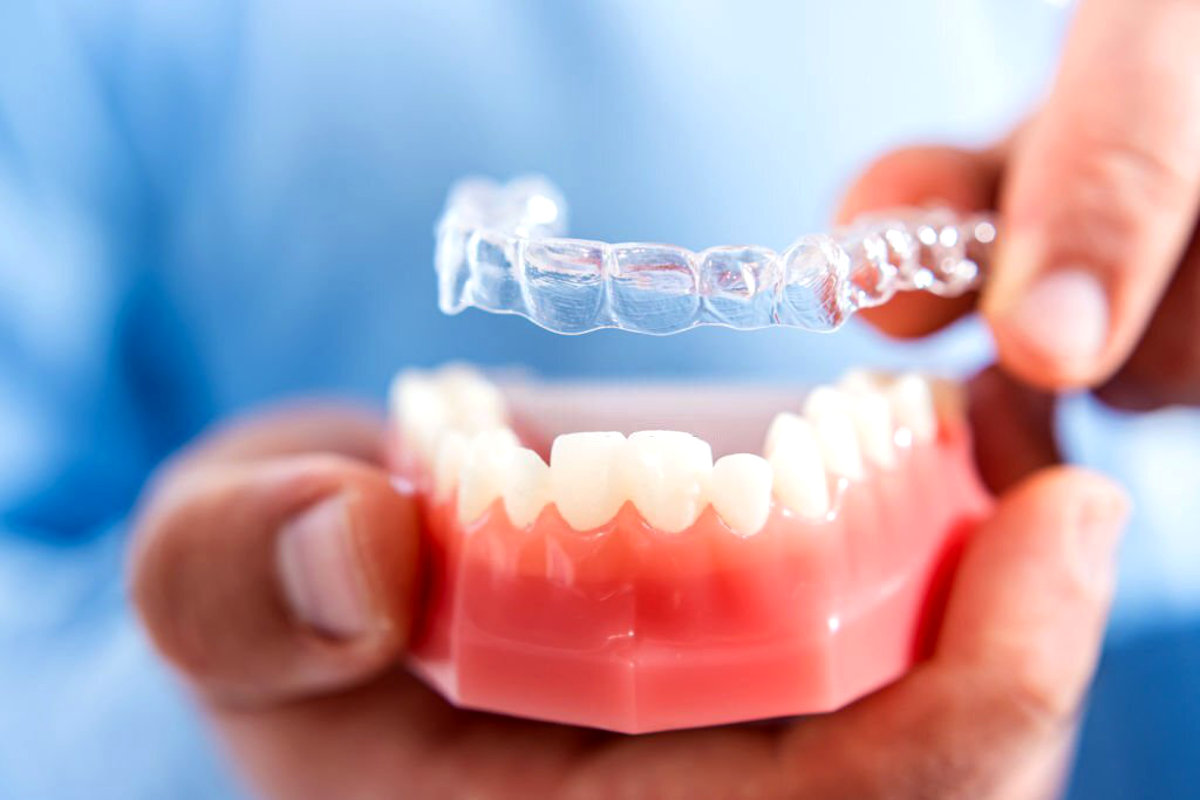 Invisalign – Sorriso perfeito com aparelho invisível → Dental Plan